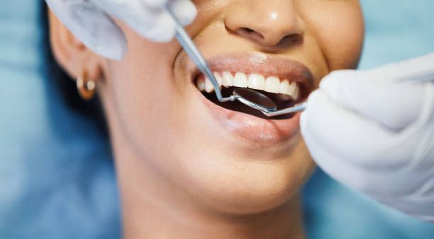 Best Emergency Tooth Extraction  in China Lake Acres, CA