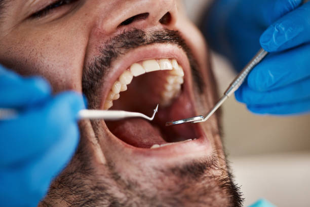 Best Urgent Dental Care  in China Lake Acres, CA